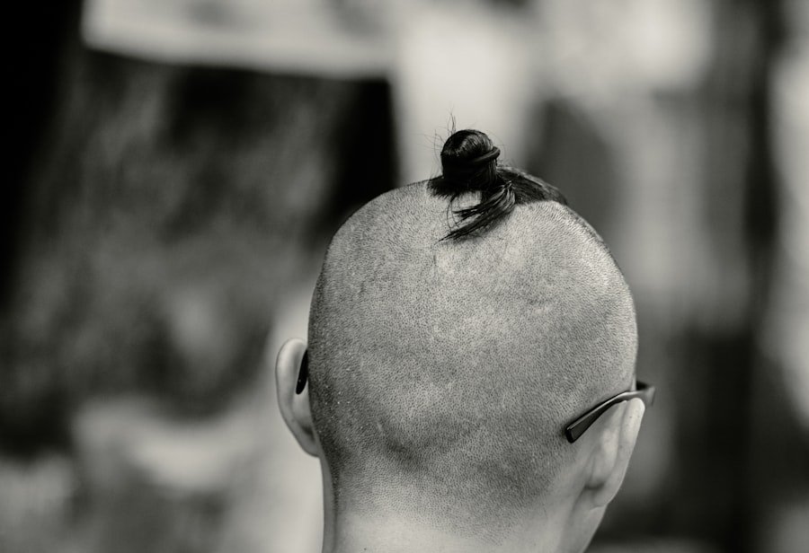 hide bald spots