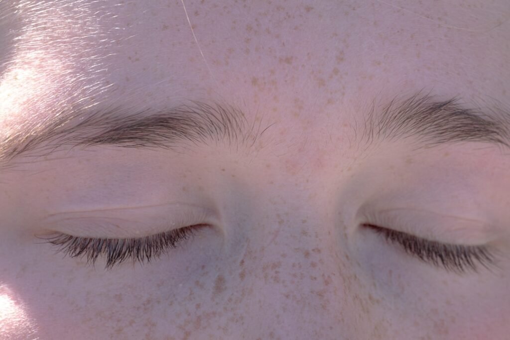 Photo bald spots