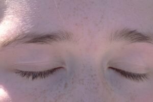 Photo bald spots