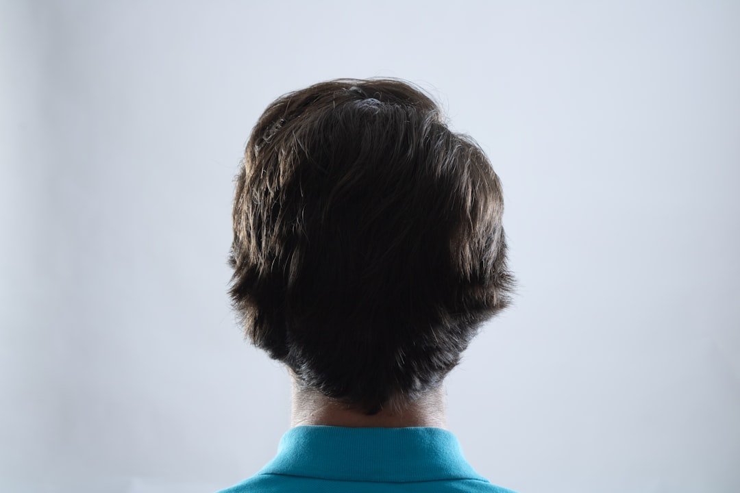Photo hair loss causes