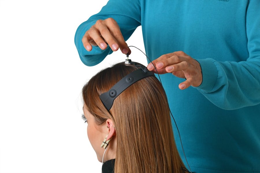 Photo hair loss treatment options