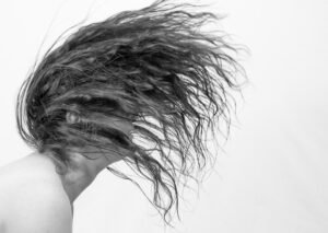 Photo hair loss stress