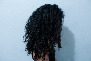 Photo thinning hair
