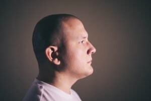 Photo bald spot