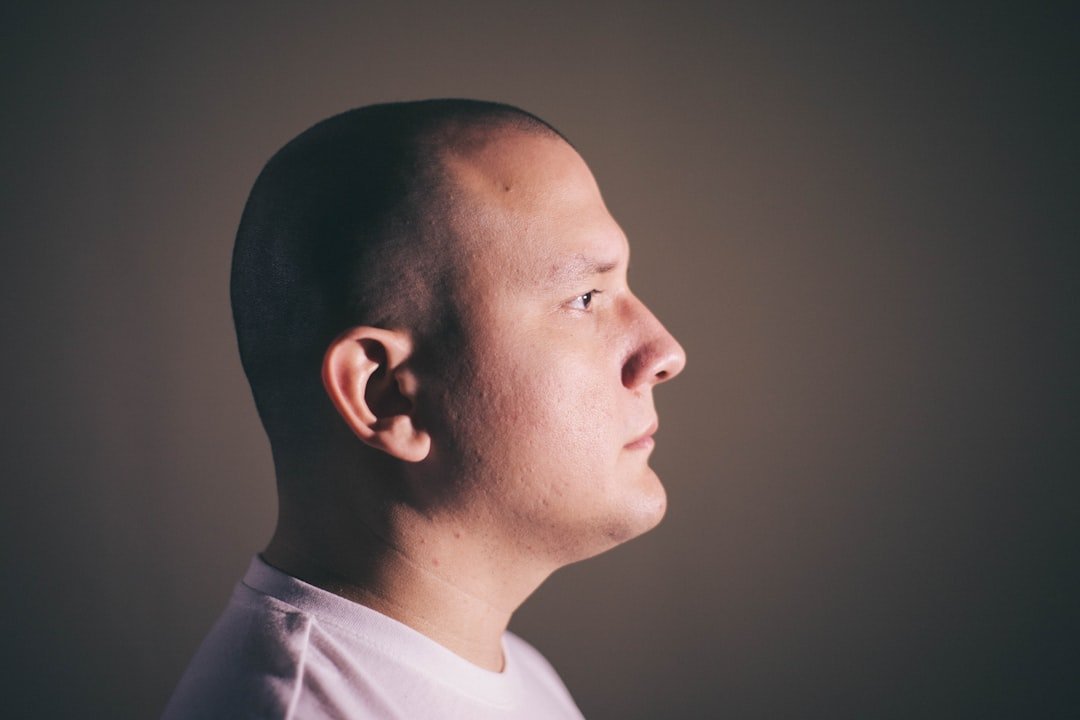 Photo bald spot