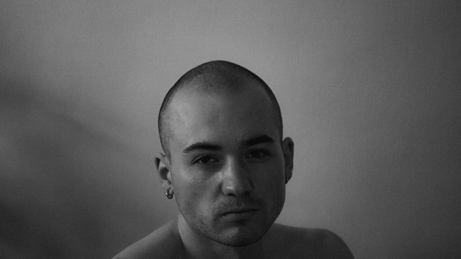 Photo bald spot