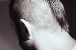 Photo hide bald spots