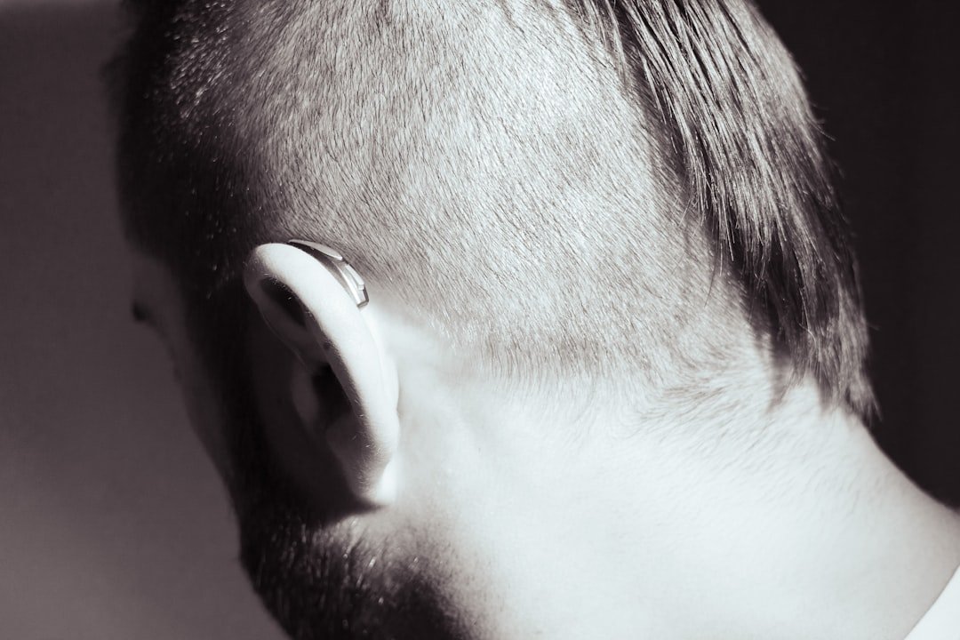 Photo hide bald spots